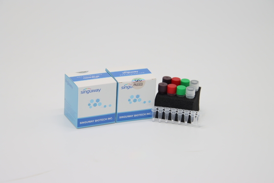 Kit PCR Waktu Nyata HIV Presisi Tinggi POCT IVD Kit Diagnostik PCR Waktu Nyata Klinis