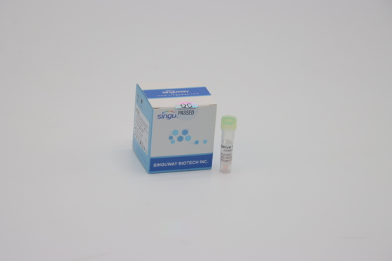 Satu Langkah Influenza PCR Kit CE Nasal Mengusap Sample Kit Pengujian Asam Nukleat