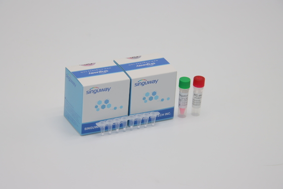 Kit Deteksi PCR Berpendar Kuantitatif Virus HIV POCT Waktu Nyata CE