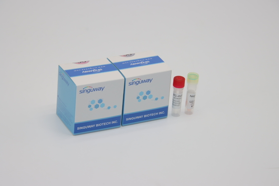 Kit Deteksi PCR Berpendar Kuantitatif IVD Untuk Semua Mutasi Virus Corona