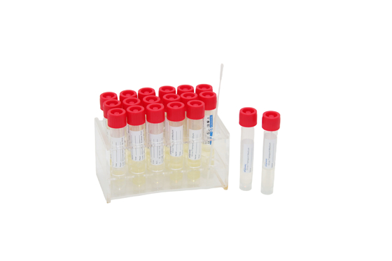 2mL Kit Pengambilan Sampel Virus Sekali Pakai Tabung Uji VTM Medis Dengan Tongkat Usap Tenggorokan