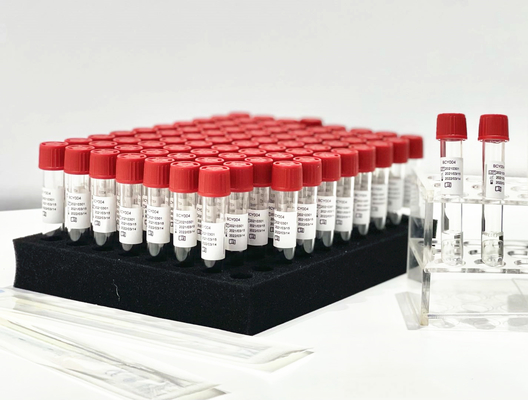 Kit Ekstraksi PCR Pelepas Sampel Satu Langkah Dari Mengusap Faring Pasien