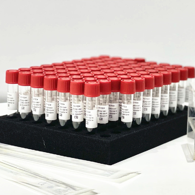 Pharynx Nasal Swab Sample Rilis Reagen Extraction Kit 0.5mL/ Tube Tanpa Preprocessing
